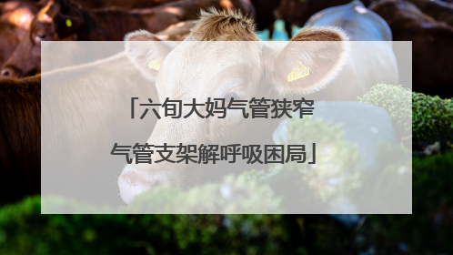 六旬大妈气管狭窄 气管支架解呼吸困局