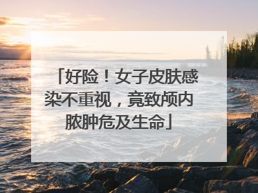 好险！女子皮肤感染不重视，竟致颅内脓肿危及生命